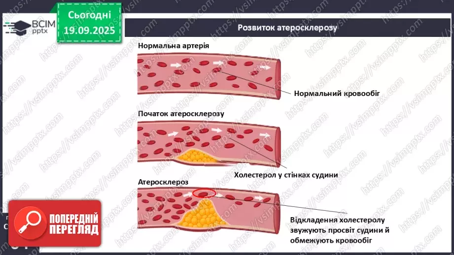 №015 - Захворювання серцево-судинної та лімфатичної систем, їхня профілактика6 №015 - Захворювання серцево-судинної та лімфатичної систем, їхня профілактика6