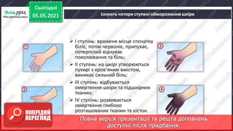 №055 - Бережи шкіру від пошкоджень!23 №055 - Бережи шкіру від пошкоджень!23