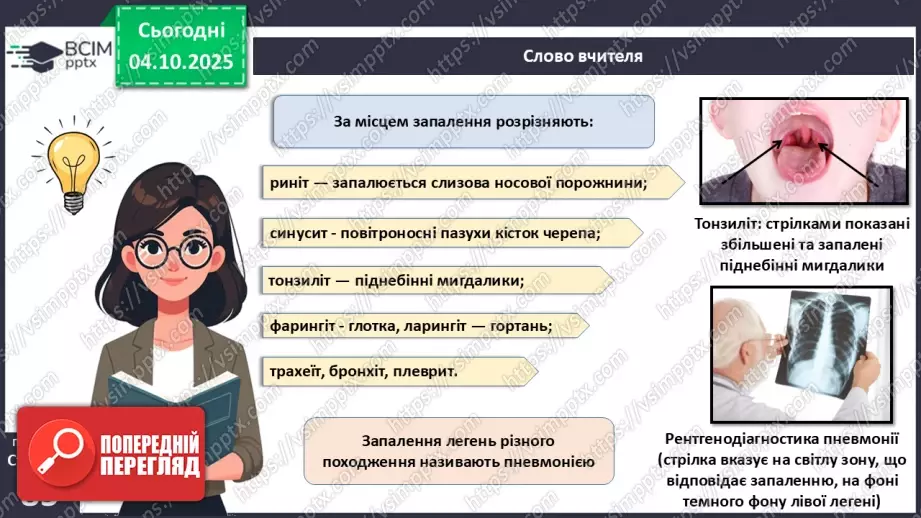 №020 - Захворювання органів дихання й голосового апарату та їхня профілактика.11 №020 - Захворювання органів дихання й голосового апарату та їхня профілактика.11