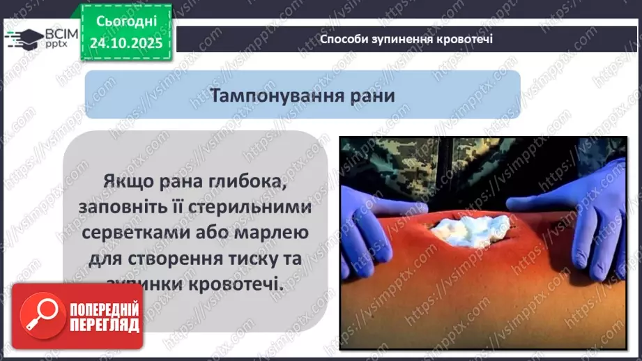 №10 - Перша допомога в надзвичайних ситуаціях.15 №10 - Перша допомога в надзвичайних ситуаціях.15