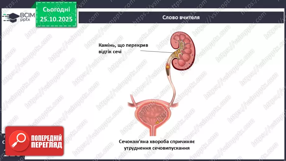 №030 - Захворювання сечовидільної системи та їхня профілактика.11 №030 - Захворювання сечовидільної системи та їхня профілактика.11