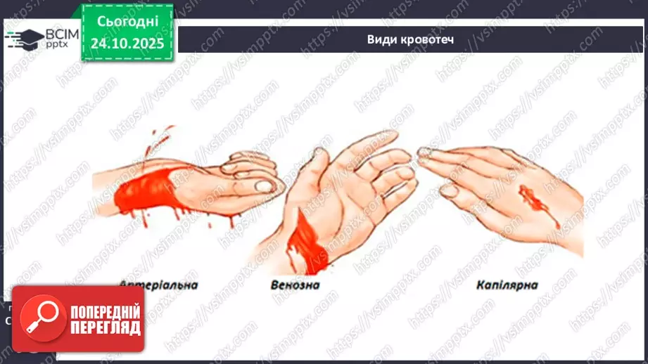 №10 - Перша допомога в надзвичайних ситуаціях.7 №10 - Перша допомога в надзвичайних ситуаціях.7