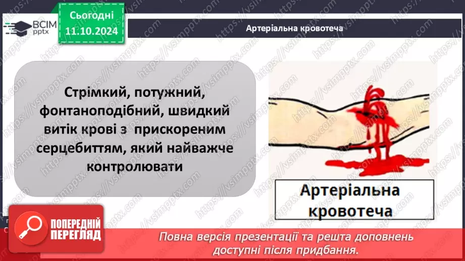 №16 - Самодопомога та невідкладна допомога. Види травм і їхні ознаки.12