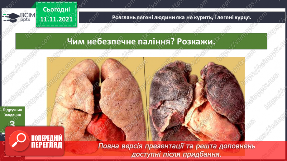 №036 - Чому лікарі кажуть, що куріння вбиває?9 №036 - Чому лікарі кажуть, що куріння вбиває?9