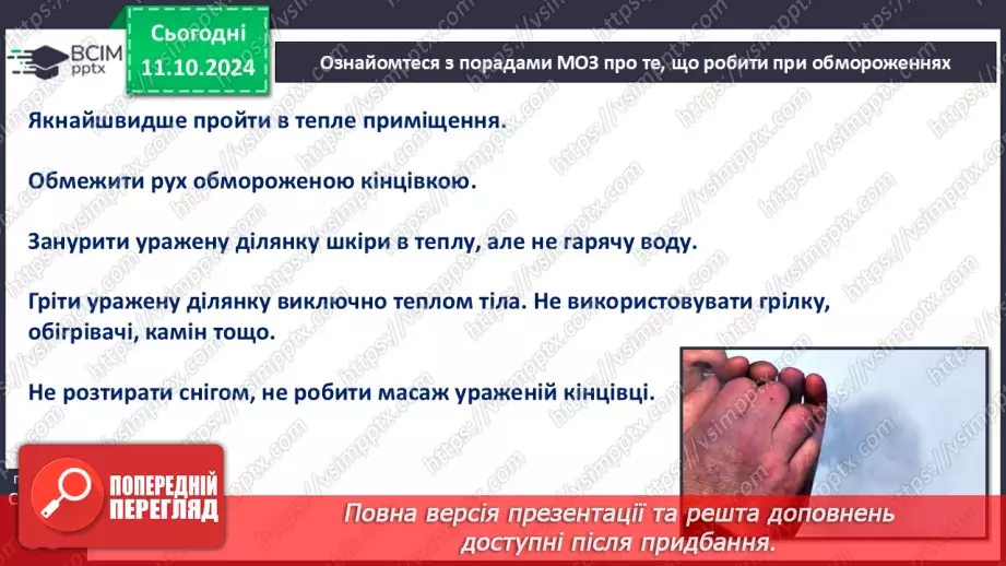 №16 - Самодопомога та невідкладна допомога. Види травм і їхні ознаки.8