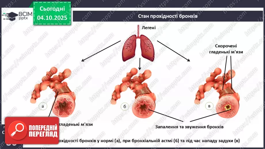 №020 - Захворювання органів дихання й голосового апарату та їхня профілактика.14 №020 - Захворювання органів дихання й голосового апарату та їхня профілактика.14