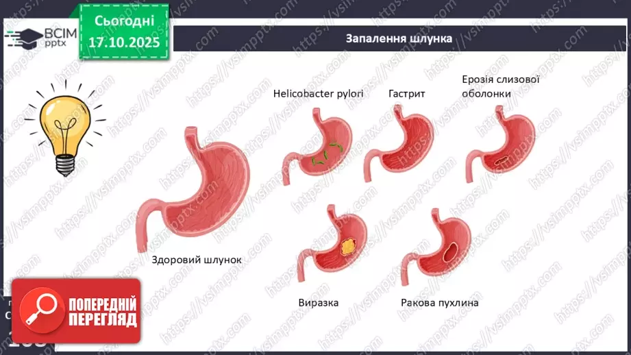 №026 - Захворювання травної системи людини та їхня профілактика..28 №026 - Захворювання травної системи людини та їхня профілактика..28
