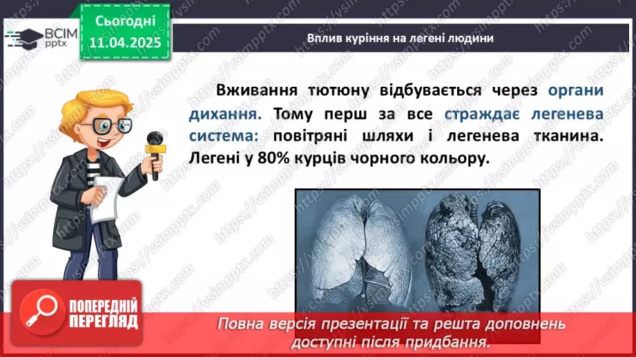 №30 - Неінфекційні захворювання. Профілактика.7 №30 - Неінфекційні захворювання. Профілактика.7