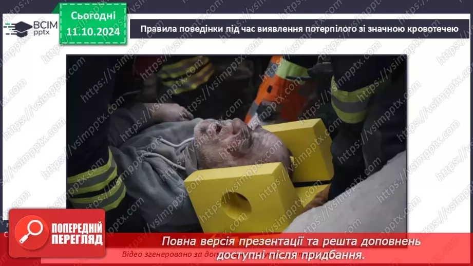 №16 - Самодопомога та невідкладна допомога. Види травм і їхні ознаки.13