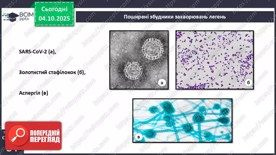 №020 - Захворювання органів дихання й голосового апарату та їхня профілактика.5 №020 - Захворювання органів дихання й голосового апарату та їхня профілактика.5