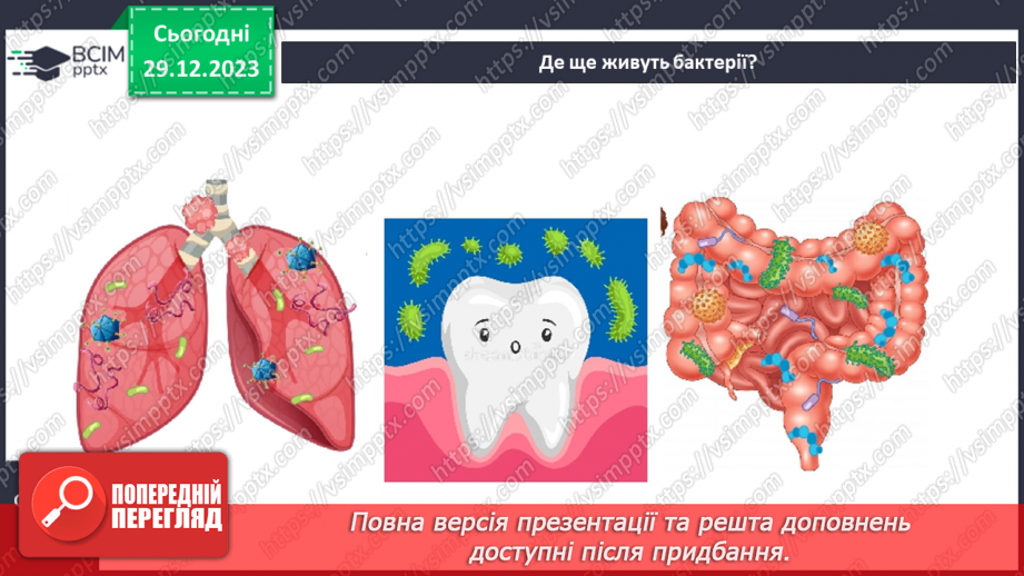 №35 - Чим особливі бактерії та віруси.8