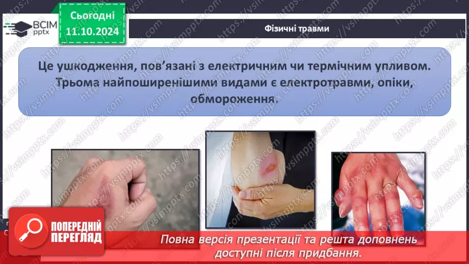 №16 - Самодопомога та невідкладна допомога. Види травм і їхні ознаки.4
