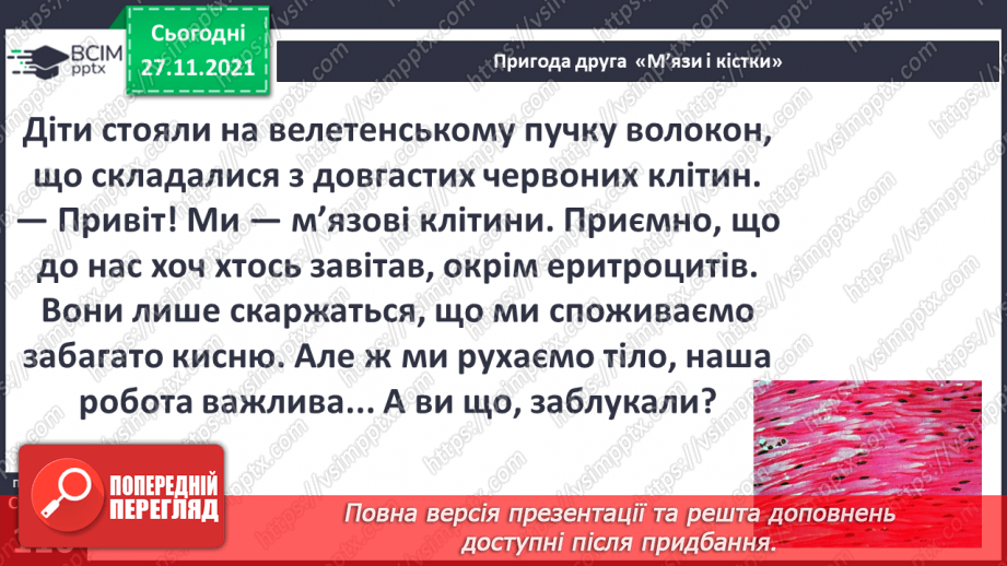 №040 - Пригода друга. М'язи та кістки.11 №040 - Пригода друга. М'язи та кістки.11
