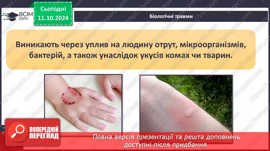 №16 - Самодопомога та невідкладна допомога. Види травм і їхні ознаки.6