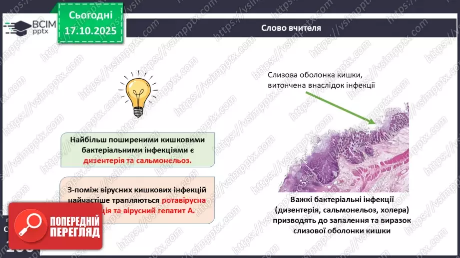№026 - Захворювання травної системи людини та їхня профілактика..14 №026 - Захворювання травної системи людини та їхня профілактика..14