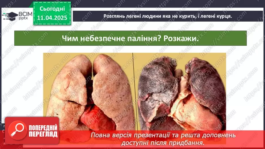 №30 - Неінфекційні захворювання. Профілактика.6 №30 - Неінфекційні захворювання. Профілактика.6