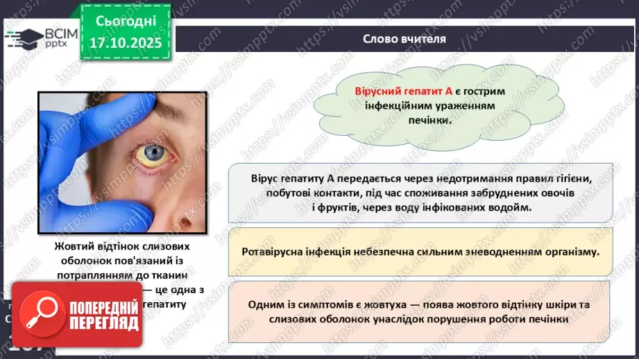 №026 - Захворювання травної системи людини та їхня профілактика..21 №026 - Захворювання травної системи людини та їхня профілактика..21