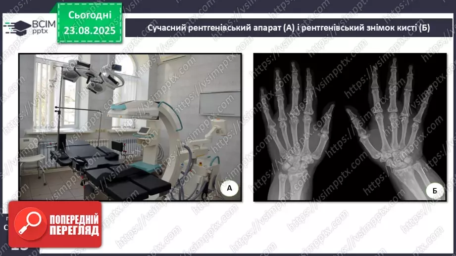 №003 - Методи дослідження організму людини.14 №003 - Методи дослідження організму людини.14
