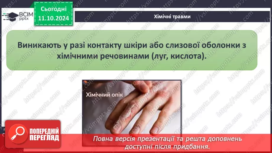 №16 - Самодопомога та невідкладна допомога. Види травм і їхні ознаки.5