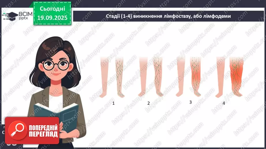№015 - Захворювання серцево-судинної та лімфатичної систем, їхня профілактика22 №015 - Захворювання серцево-судинної та лімфатичної систем, їхня профілактика22