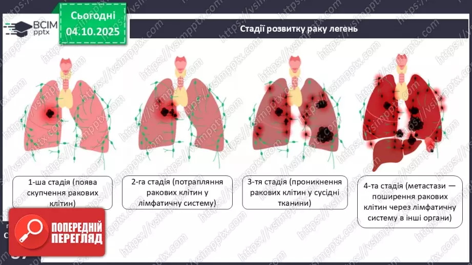 №020 - Захворювання органів дихання й голосового апарату та їхня профілактика.18 №020 - Захворювання органів дихання й голосового апарату та їхня профілактика.18