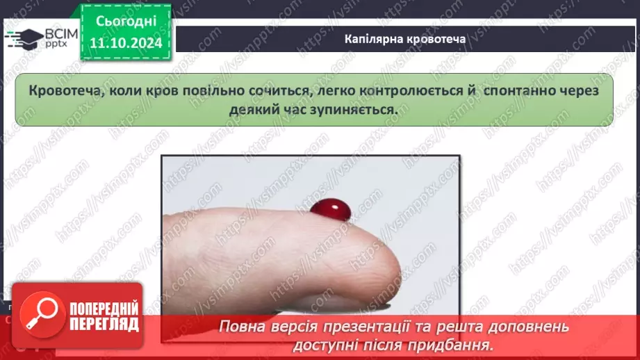 №16 - Самодопомога та невідкладна допомога. Види травм і їхні ознаки.10