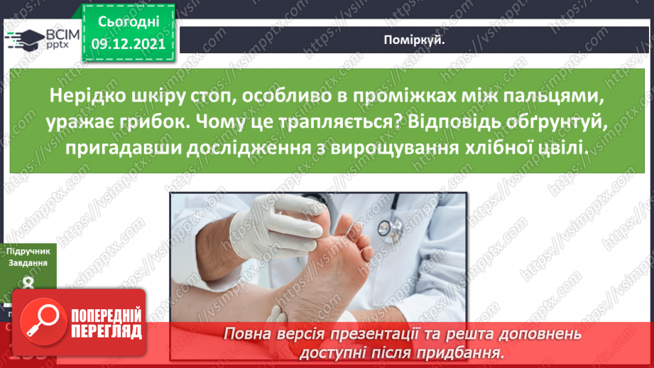 №047-48 - Для чого людині шкіра? Чи робить нас різними колір шкіри?13 №047-48 - Для чого людині шкіра? Чи робить нас різними колір шкіри?13