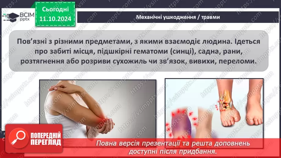 №16 - Самодопомога та невідкладна допомога. Види травм і їхні ознаки.3